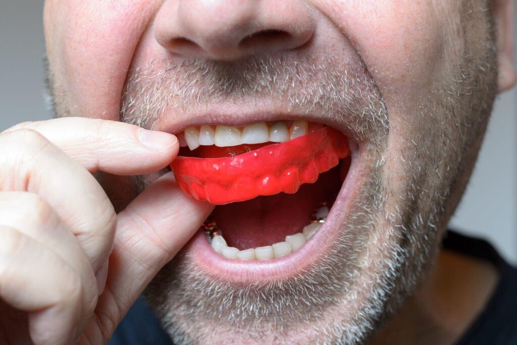 Explanation of Bruxism