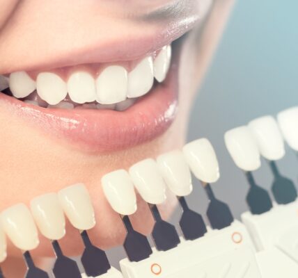 The Comprehensive Guide to Cosmetic Dentistry