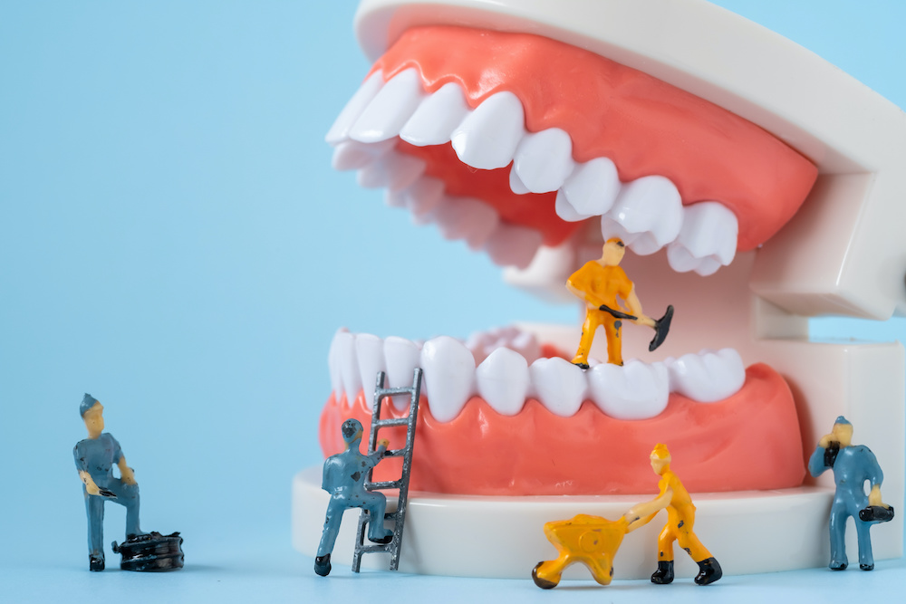 How Can Preventive Care Help Me Maintain A Beautiful Smile?