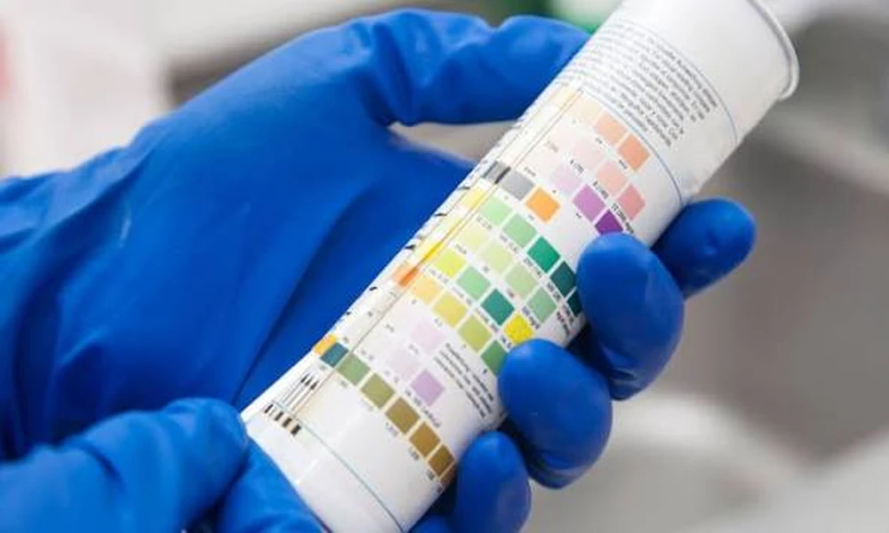 Synthetic Urine Kits: Supporting Laboratory Testing And Training Activities